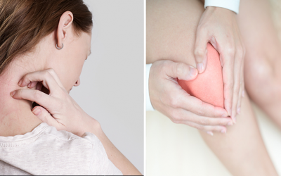 What are the benefits of cryotherapy for skin?